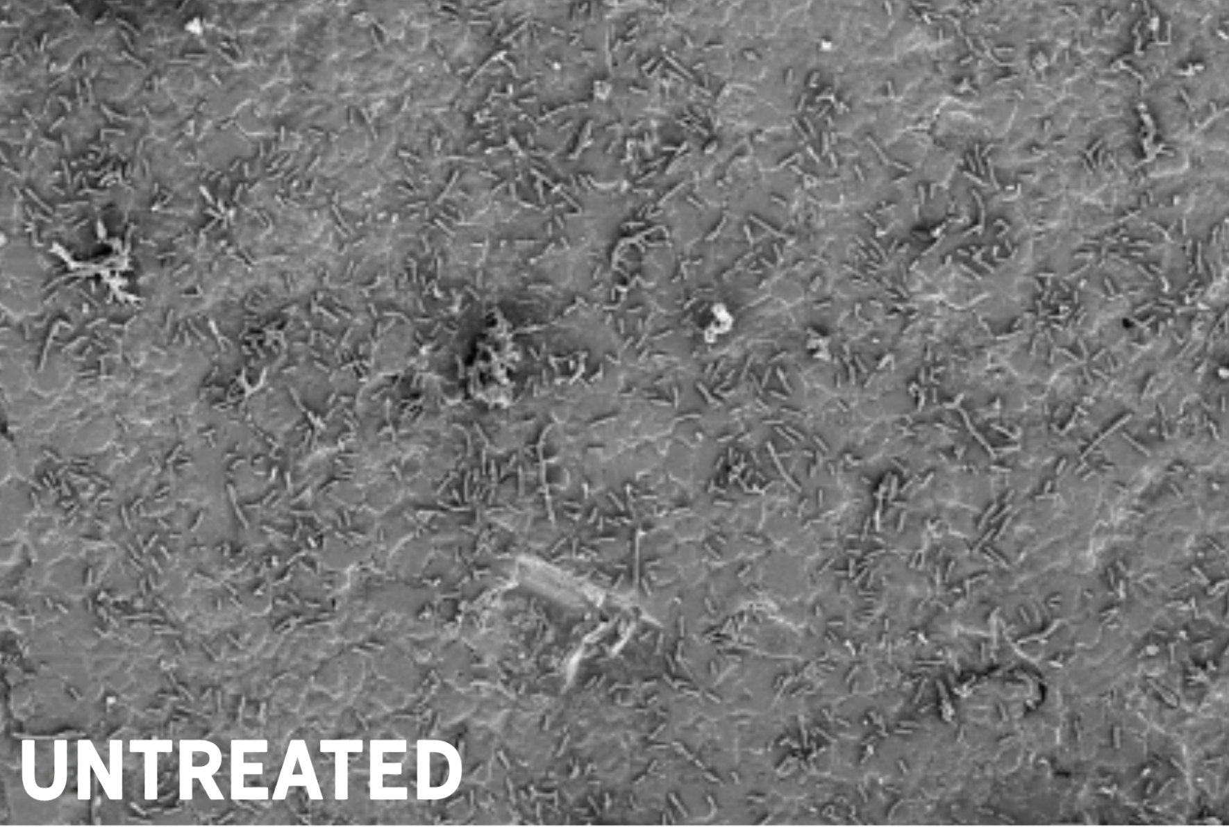 Bacteria formation on untreated stainless steel finish